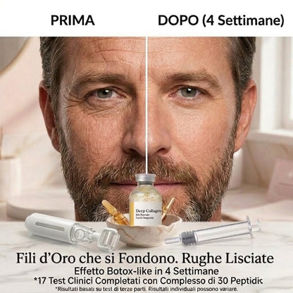 Kit Derma Roller + Siero Collagene — Lifting Viso Professionale a Casa