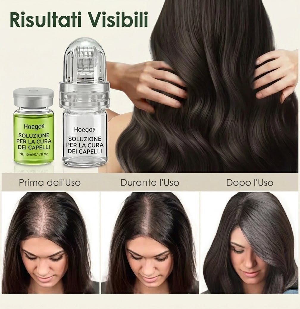 Kit 8 Fiale Anticaduta Hoegoa — Nutre, Rinforza & Stimola la Ricrescita