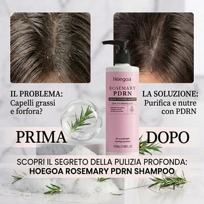 Hoegoa Rosemary PDRN — Kit Shampoo & Balsamo Anti-Caduta e Infoltimento