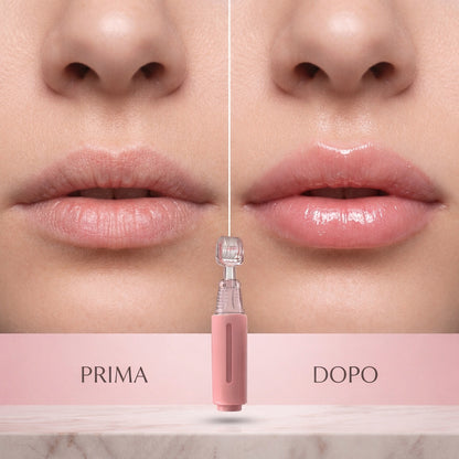 Plumping Lip Kit Volumizing Effect