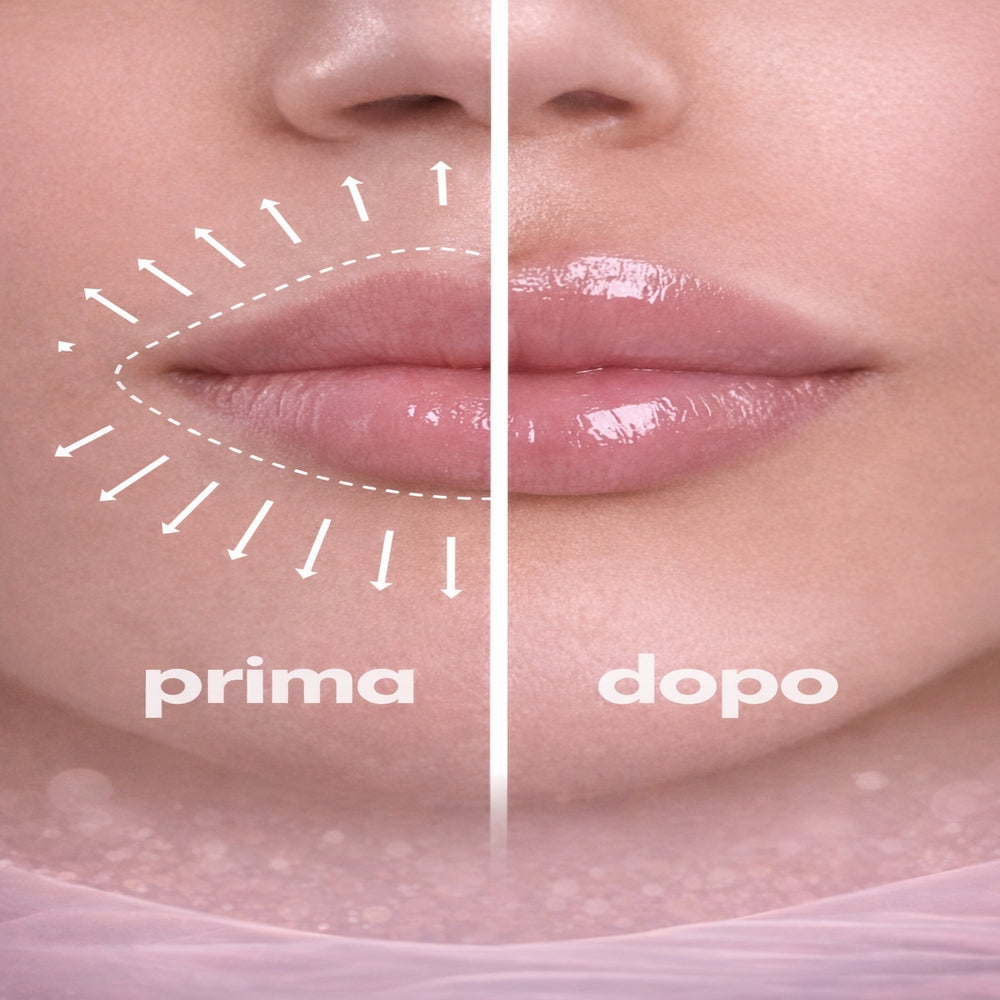 Derma Roller Lifting Labbra